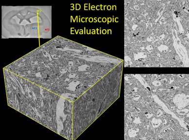 3D microscope evaluation