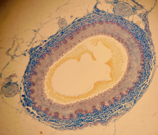 Artery