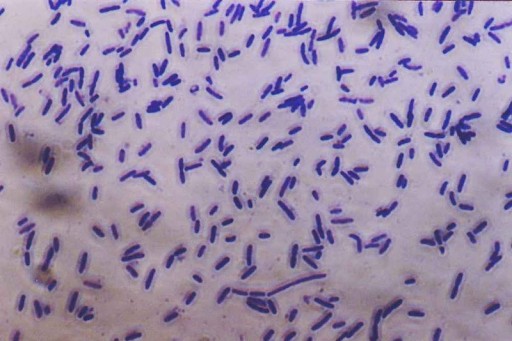 Bacteria_photomicrograph
