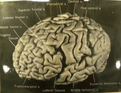 AE brain