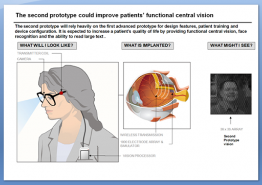 Advanced retinal implant