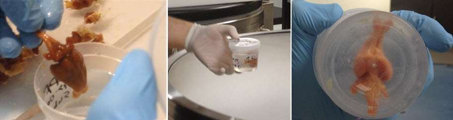 Aldehyde Stabilized Cryopreservation surgical procedure