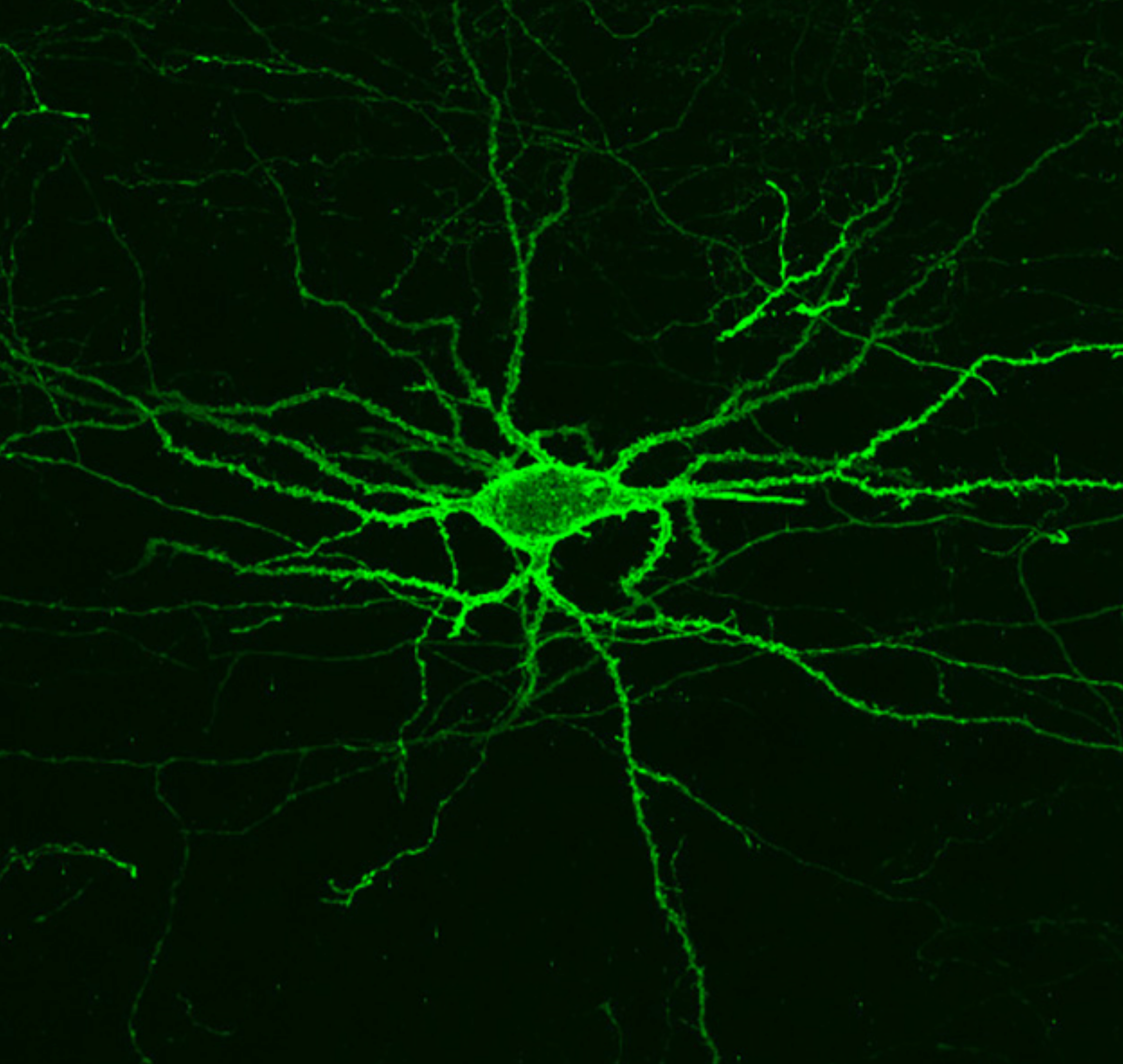 Brain neurons. Нейроны мозга. Зеленые Нейроны. Электрическая нейронная активность. Электрические импульсы на растения.