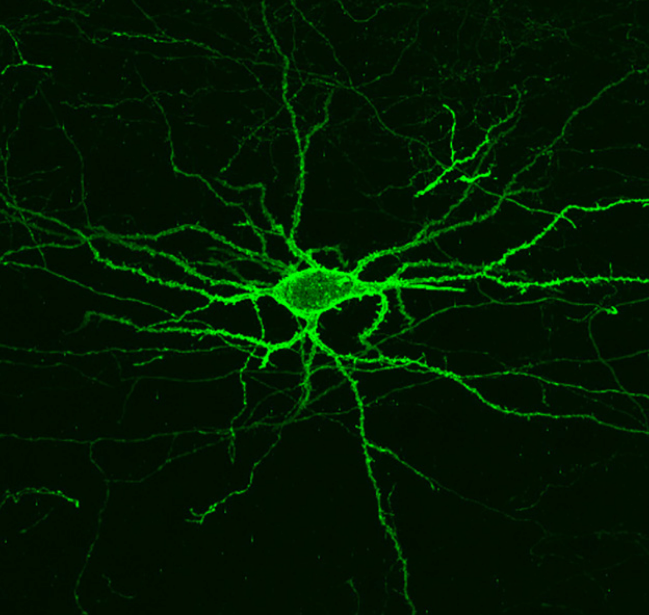 Brain neurons