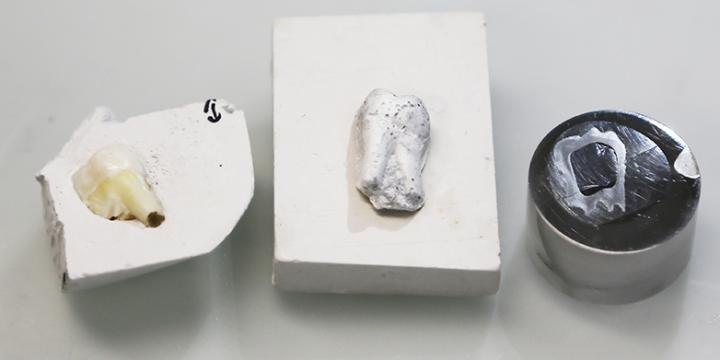 Artificial Tooth