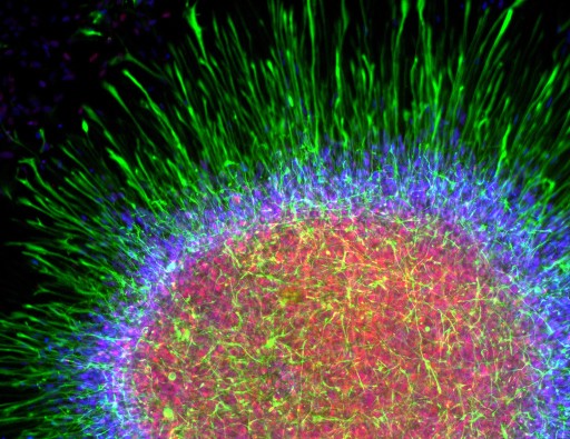 Astrocyte Cell