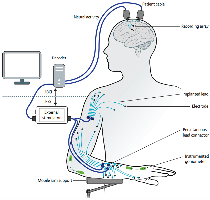 BCI-muscle-stimulation system