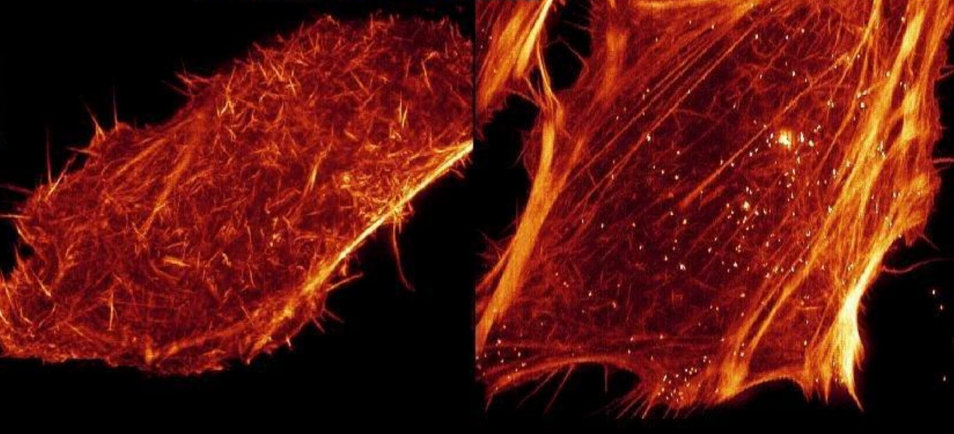 Bessel SIM vs lattice SIM
