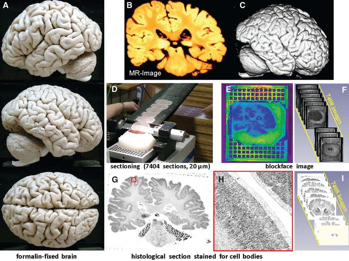 BigBrain tissue and image processing.