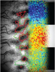 Brain-Image
