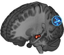 Brain