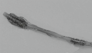Catheter no description_nih Catheter no description_nih