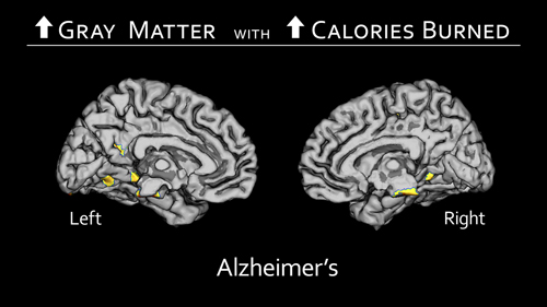 Cerebral hemispheres Figure 2
