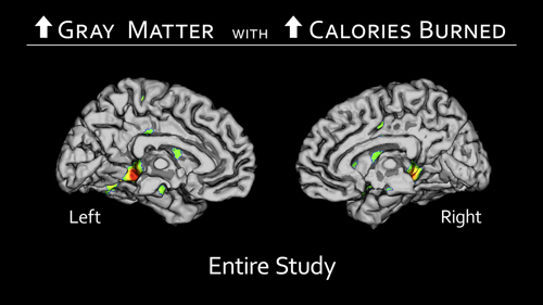 Cerebral hemispheres Figure 1