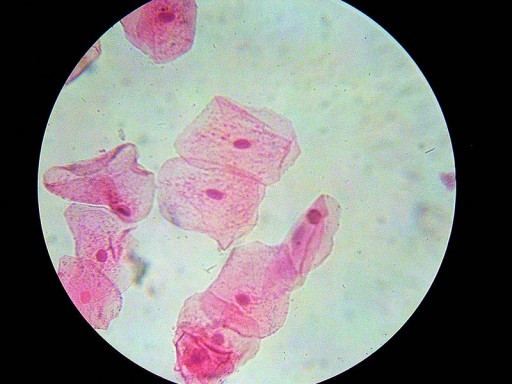 Cheekcells_stained
