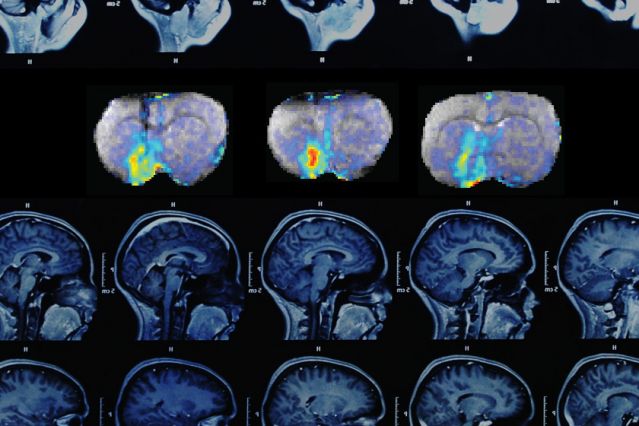 DopamineMRI
