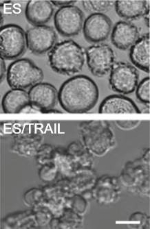 ES-TRAIL liposome