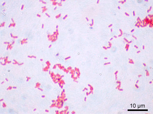 Escherichia_coli_Gram