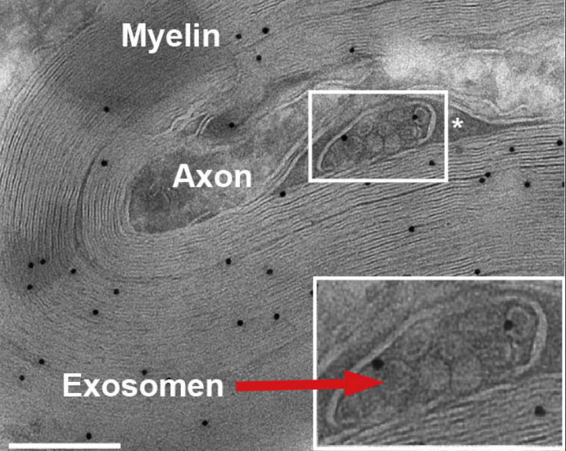 Exosomen
