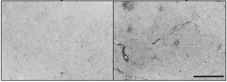Fe radiation effects