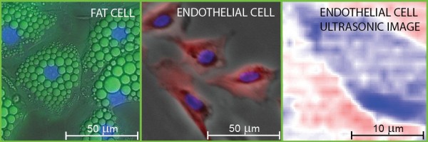 Fluorescence micrographs of fat and endothelial cells