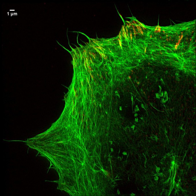 Focal adhesions and actin-jpeg