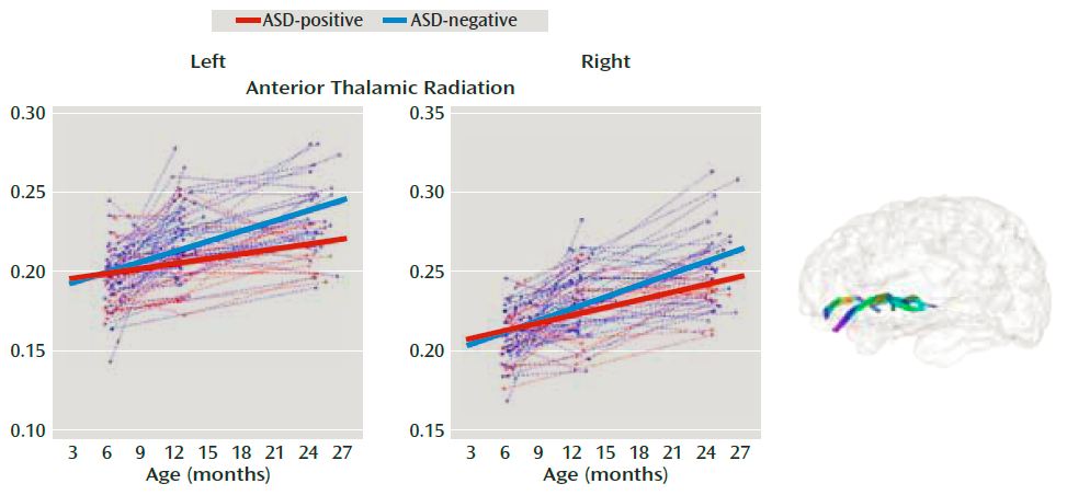 FractionalAnisotropyinWhiteMatter FractionalAnisotropyinWhiteMatter