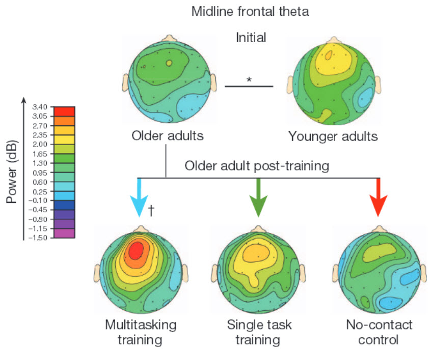 Frontal_theta_activity