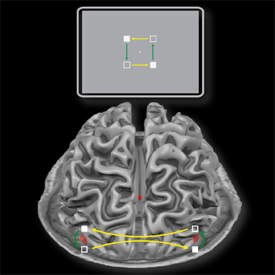 Bistable Motion Brain Illustration