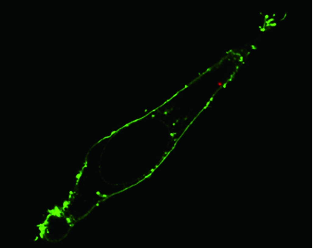 HeLa-Cell HeLa-Cell