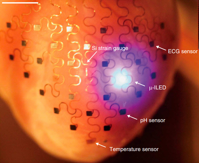 Heart-membrane-electronics