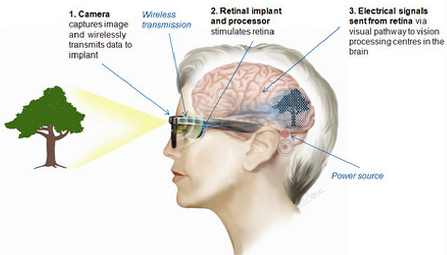 High-Acuity device