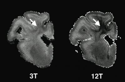 Highfield-MRI Highfield MRI