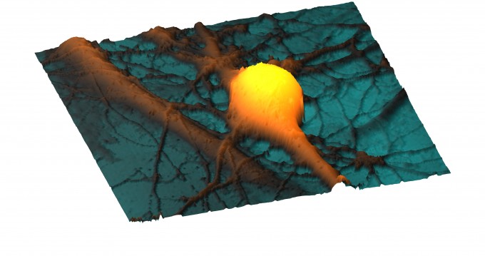 HippocampalNeurons_060710_1458_002t_3DView_NoBars
