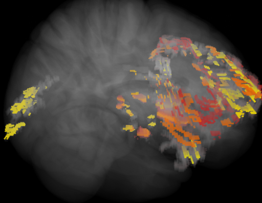 Indirection_glassbrain