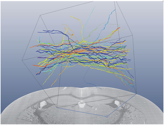 Scanning electron microscopic mosaic of a coronal blockface