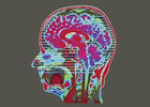 MRI-Head MRI Head