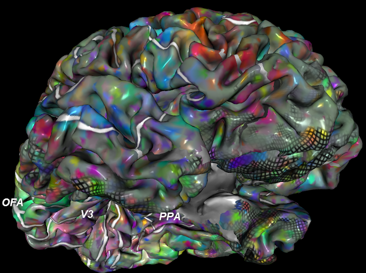 MRI-neocortex