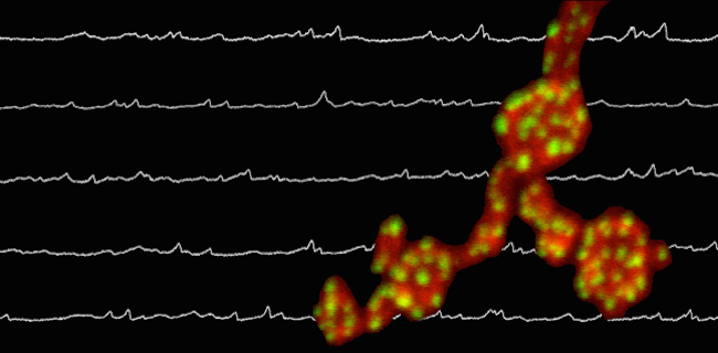 McCabe-CUMC-image-brain-noise