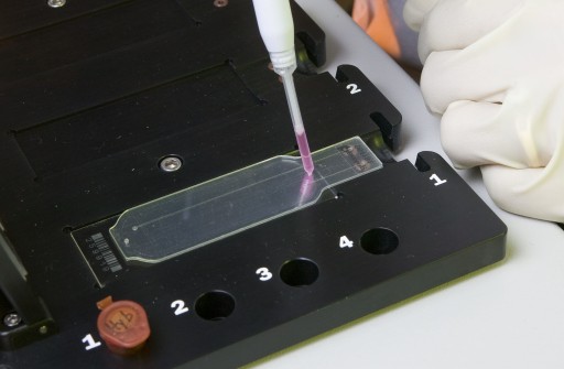 Microbial Detection Array