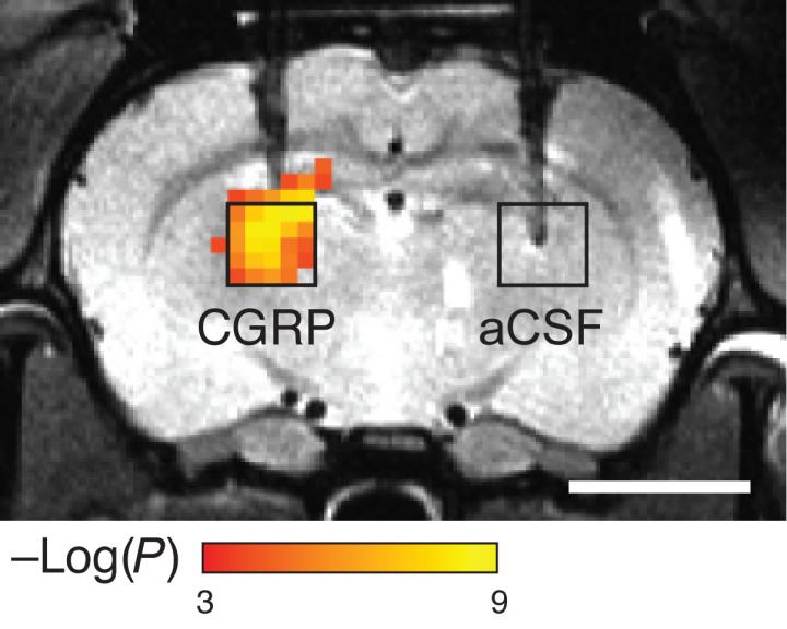 Molecular Imaging