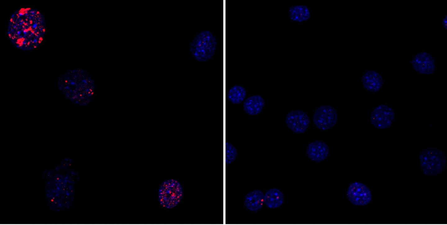 Mouse Fibroblast Cells Rejuvinated by Partial Reprogramming