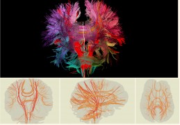Neural-Map Neural Map