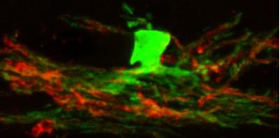 Neural Stem Cells