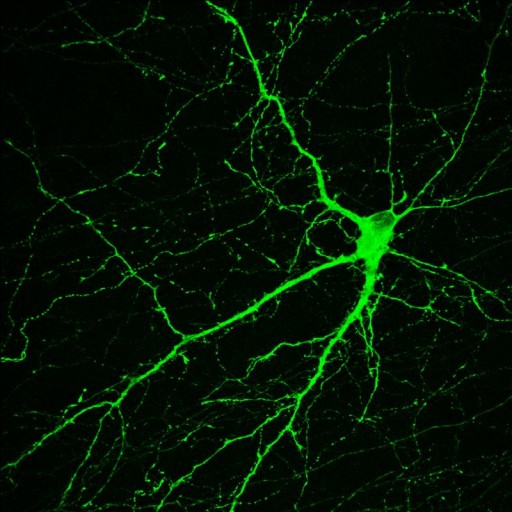 Neuron