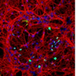 Neuronal cells