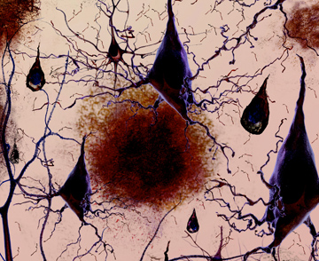 NeuronsandTangles-NIA2