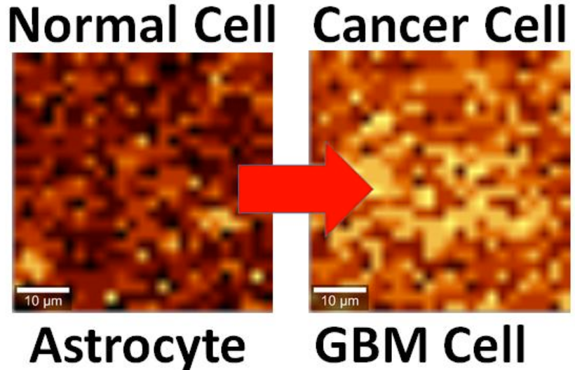 Normal vs GBM astrocytes