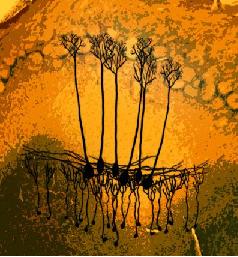 Olfactory Bulb