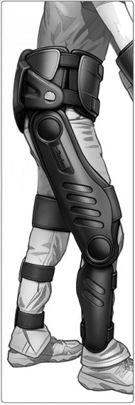 Parker concept